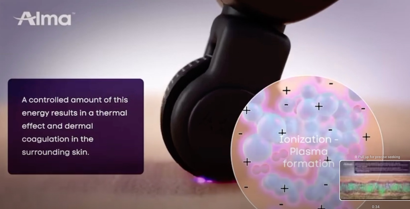  Alma Opus-How it works