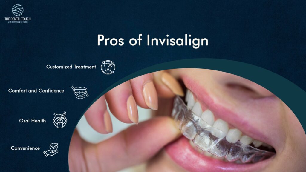 Pros of Invisalign