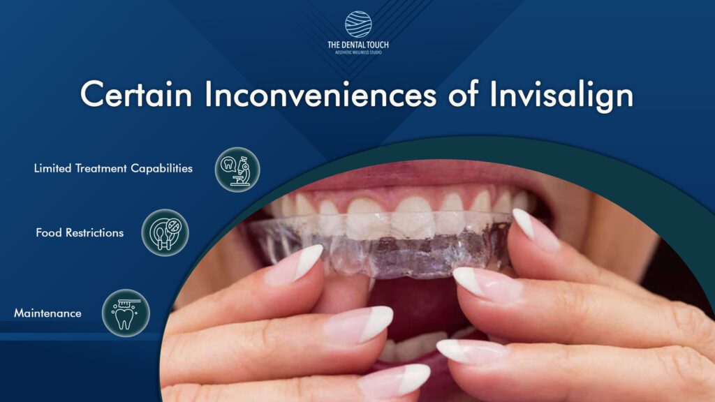 Invisalign