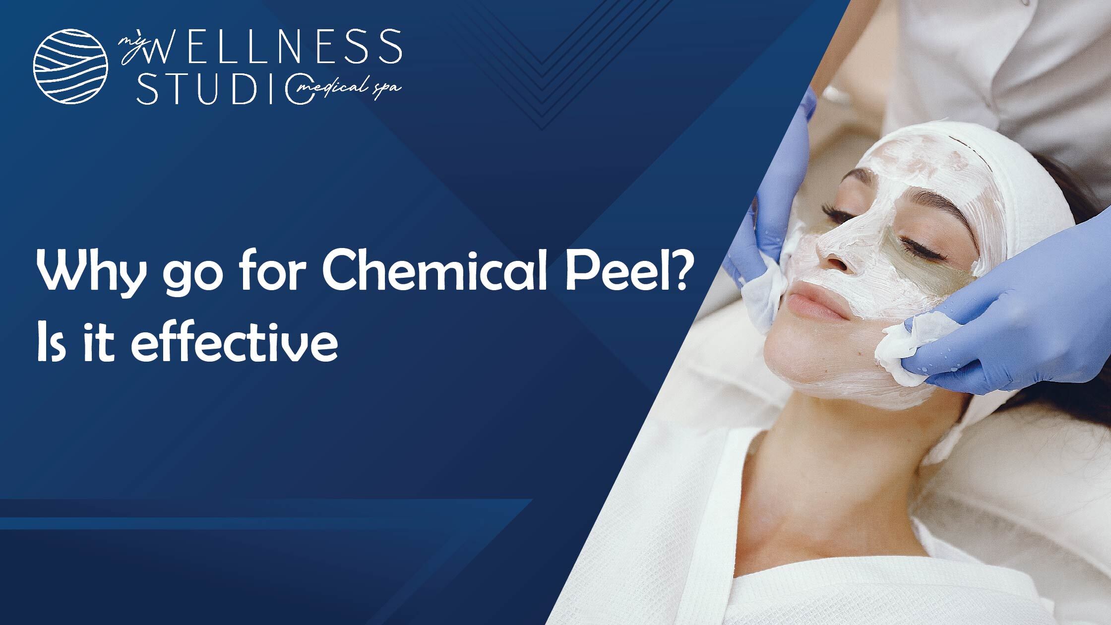 chemical peel