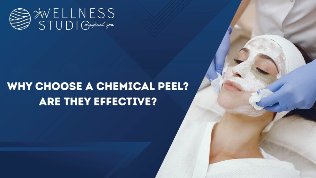 Why choose a chemical peel? Are they effective?