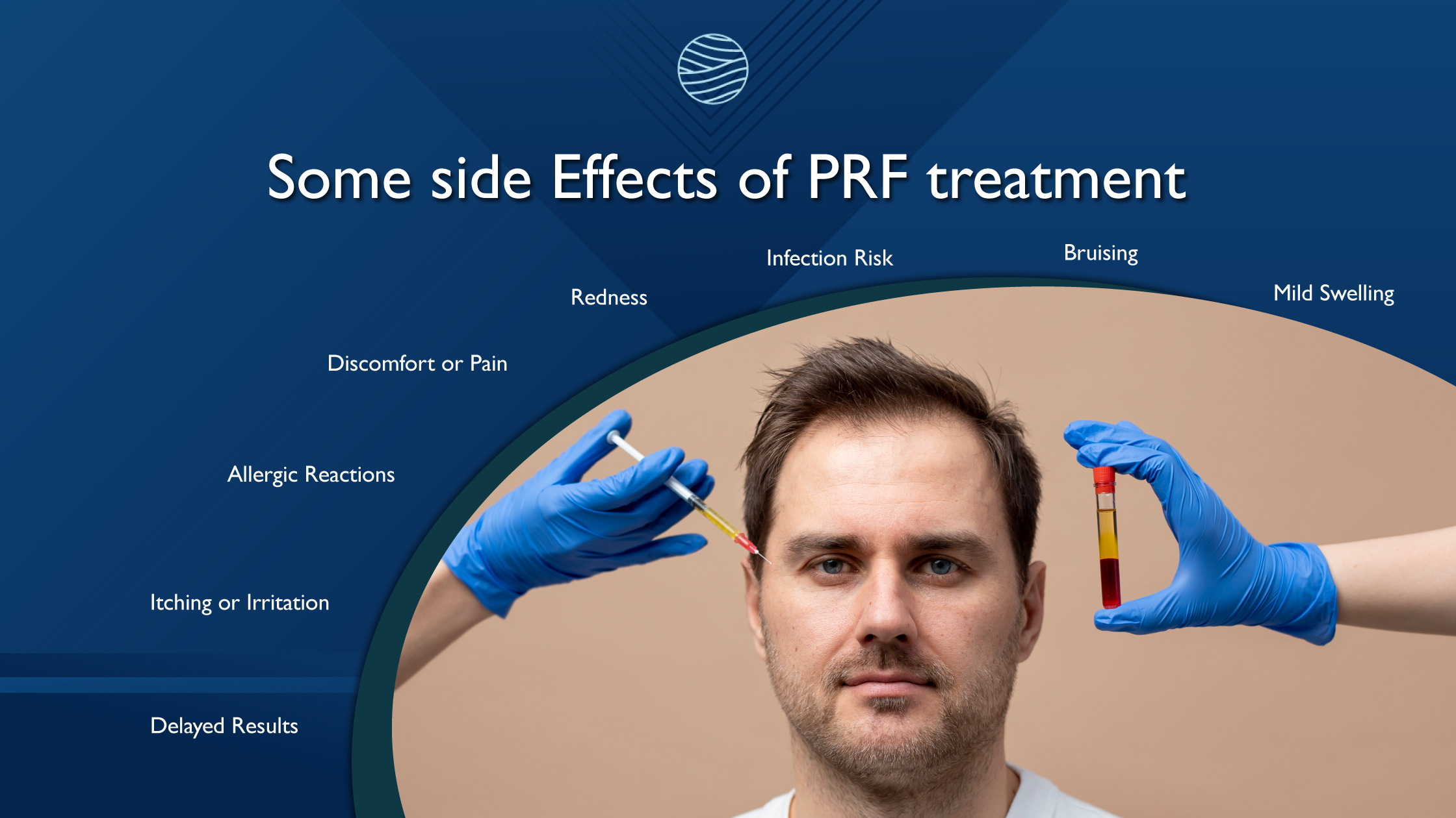 PRF Treatments