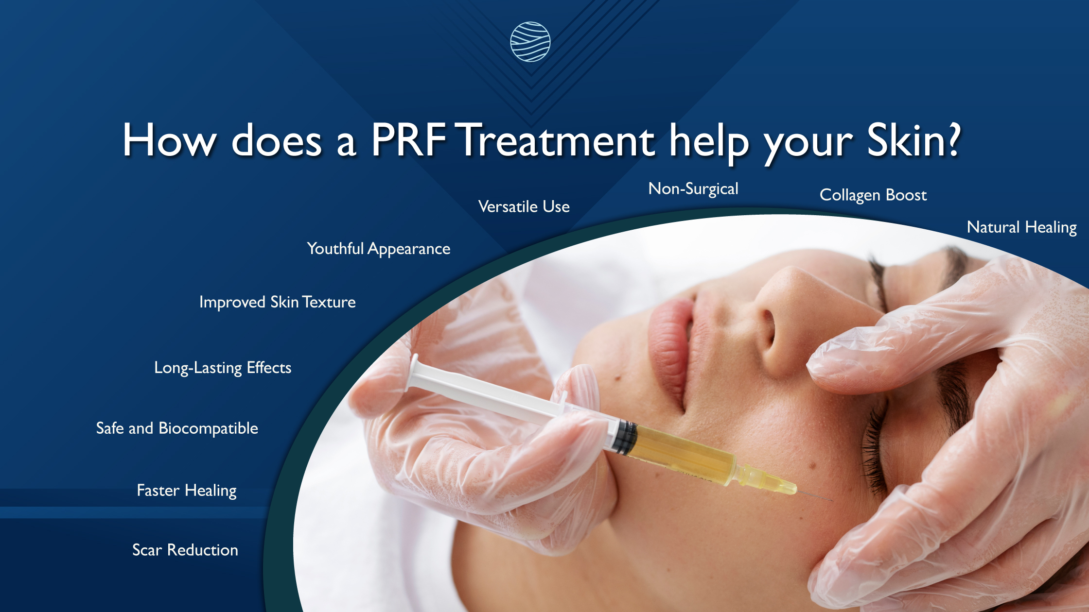 PRF Treatments