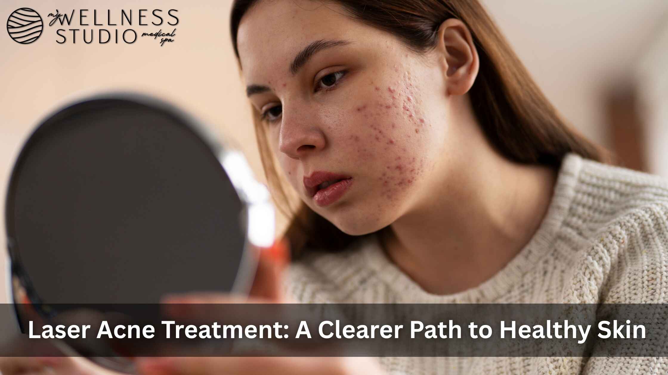 Laser Acne Treatment: A Clearer Path to Healthy Skin