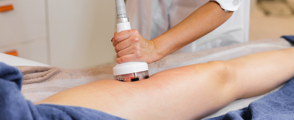 Radiofrequency (RF) Therapy
