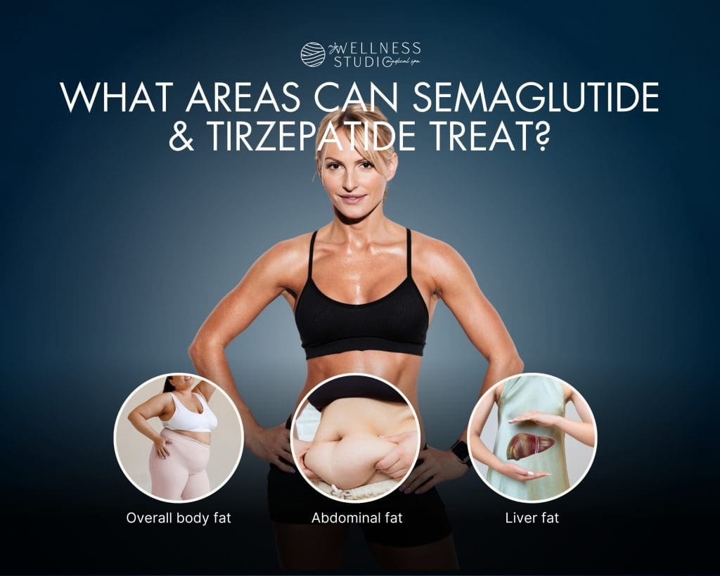 Semaglutide & Tirzepatide in Leesburg, FL: Effective Weight Loss ...